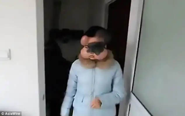 She now faces several months of coping with the balloons stretching her skin in four areas before she can have her 'new face' 