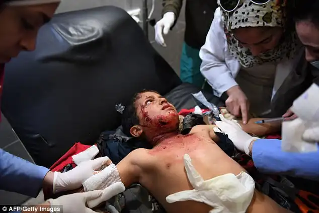 Injured: child wounded following a Turkish airstrike is pictured receiving treatment in following a Turkish airstrike on a village in the Afrin district on Sunday